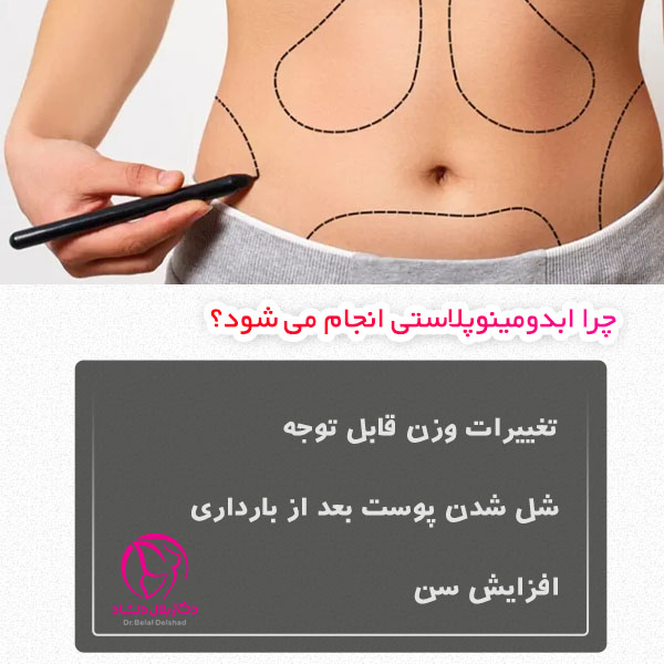چرا عمل ابدومینوپلاستی انجام می شود؟