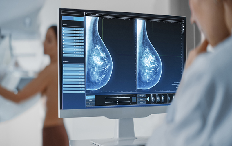 ماموگرافی در کرج
