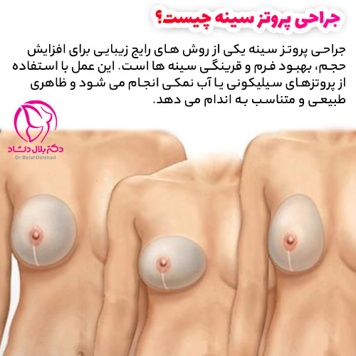 جراحی پروتز سینه چیست؟