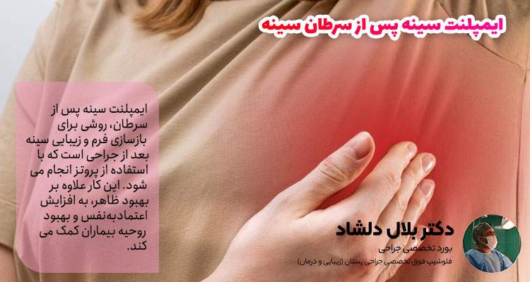 ایمپلنت سینه پس از سرطان سینه