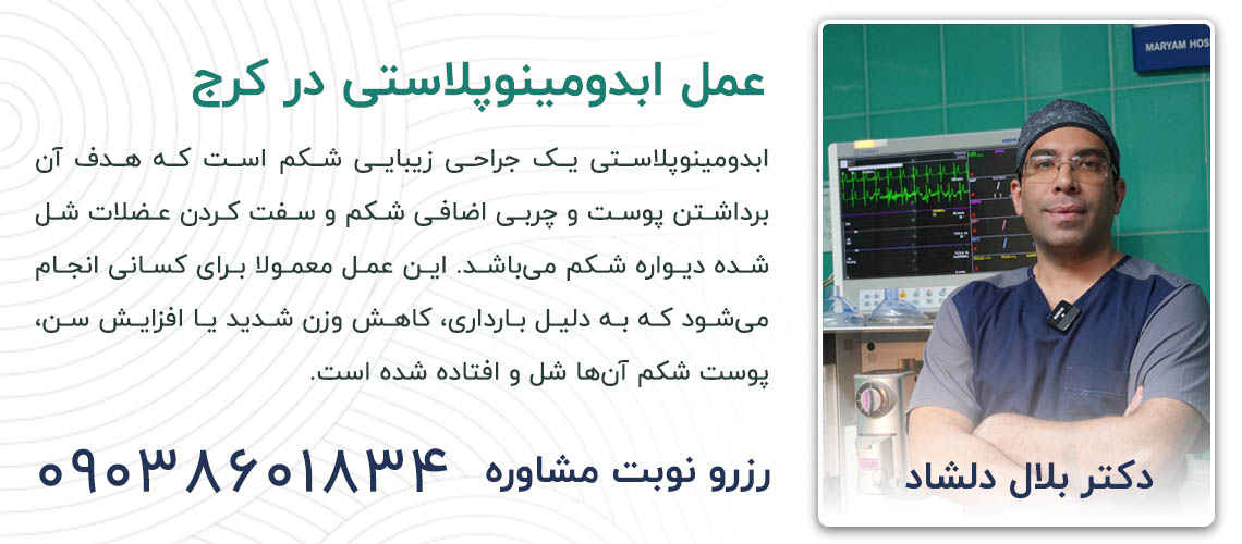 ابدومینوپلاستی در کرج