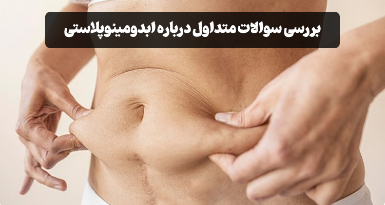 سوالات متداول ابدومینوپلاستی
