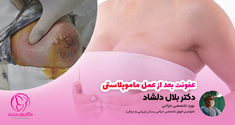عفونت بعد از عمل ماموپلاستی